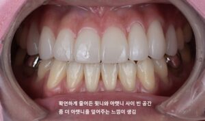 라미네이트