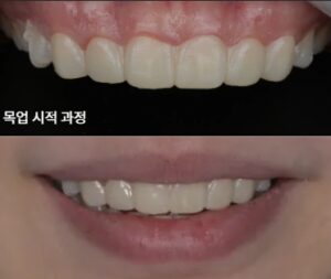 최소 삭제