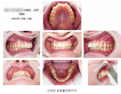 안산교정치과