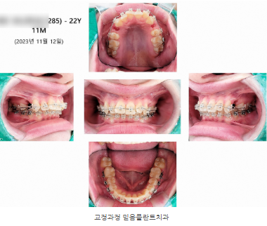 안산교정치과