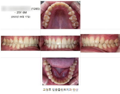 안산교정치과