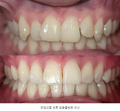 안산교정치과