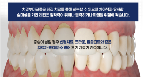 안산치과 믿음플란트 임플란트 사례