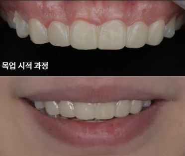 최소 삭제