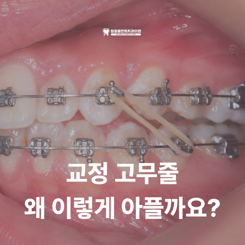 교정 고무줄 통증, 계속 아픈 게 정상일까요?