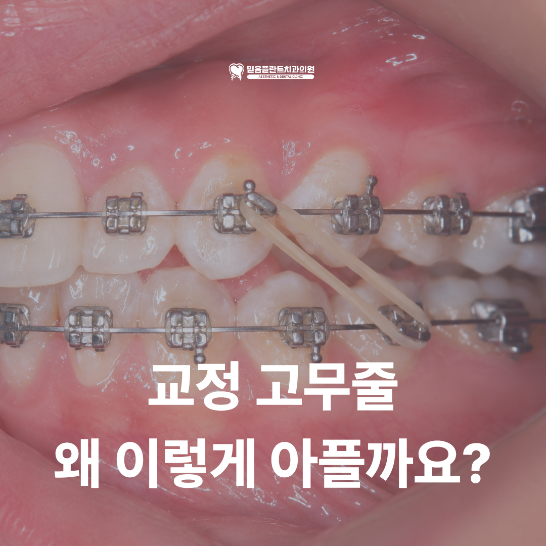교정 고무줄 통증, 계속 아픈 게 정상일까요?