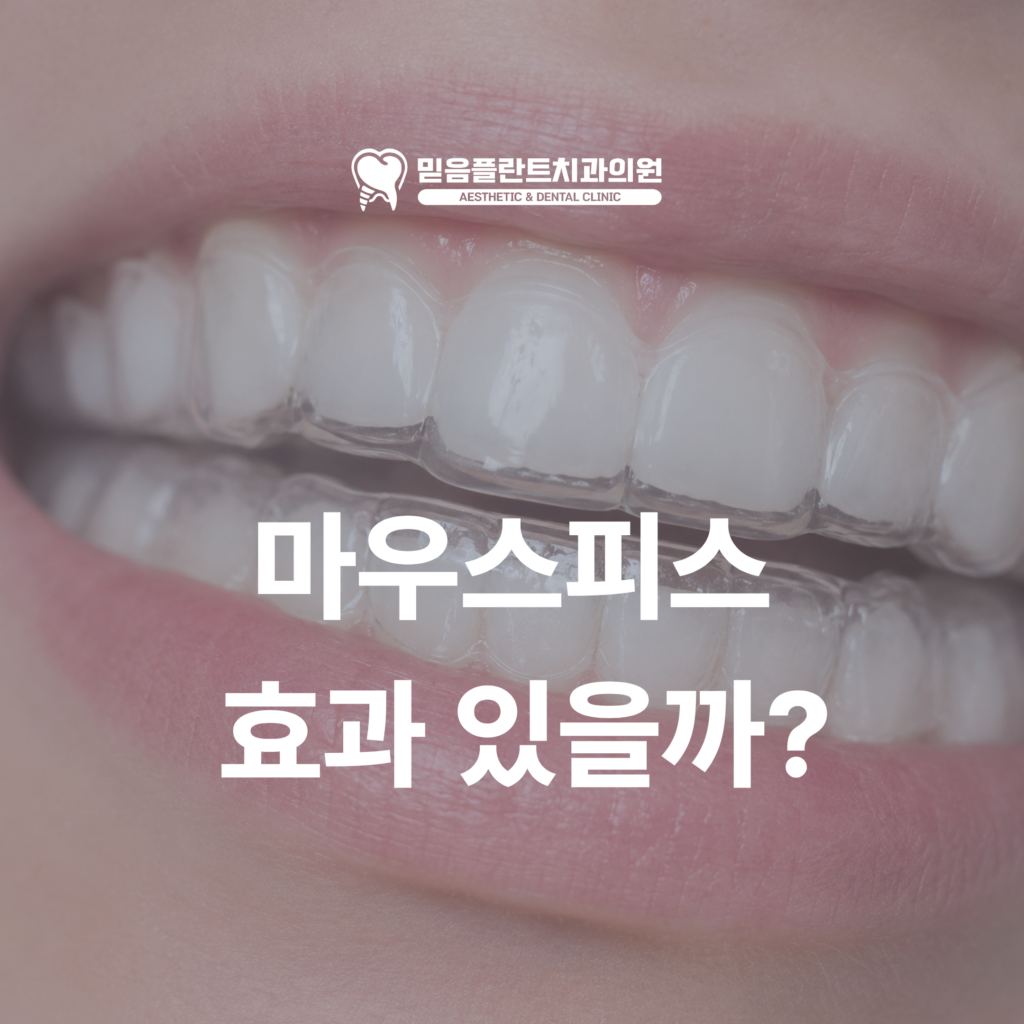 마우스피스 효과 있을까? 이갈이와 턱관절 통증 때문에 내원하시는 분들께